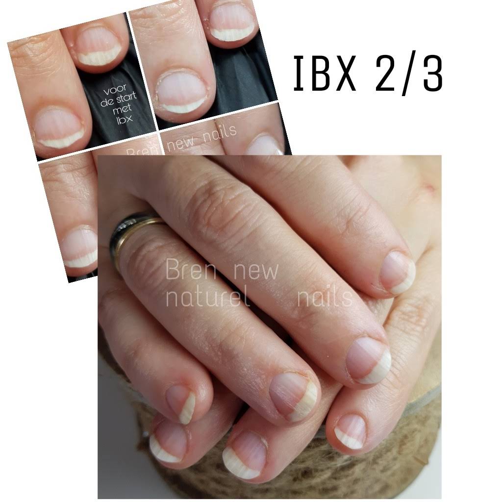 ibx nail treatment bij beschadigde nagels of nagelproblemen zoals nagelbijten
